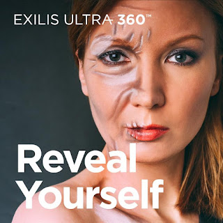 Exilis Ultra 360 2 shy pte ltd