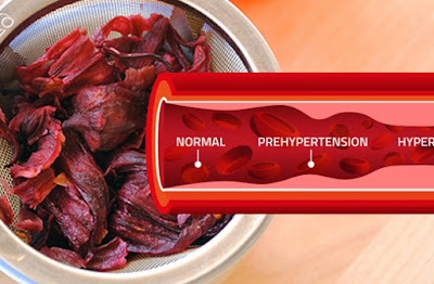 5 Herbs That Anyone With High Blood Pressure Needs To Know About 5 Herbs That Anyone With High Blood Pressure Needs To Know About