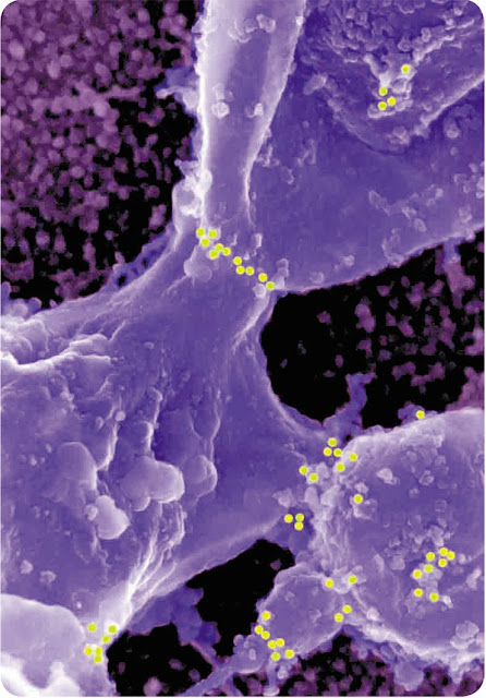 «Место встречи изменить нельзя». Локализация белка ретикулона в участках слияния пузырьков эндоплазматического ретикулума.
