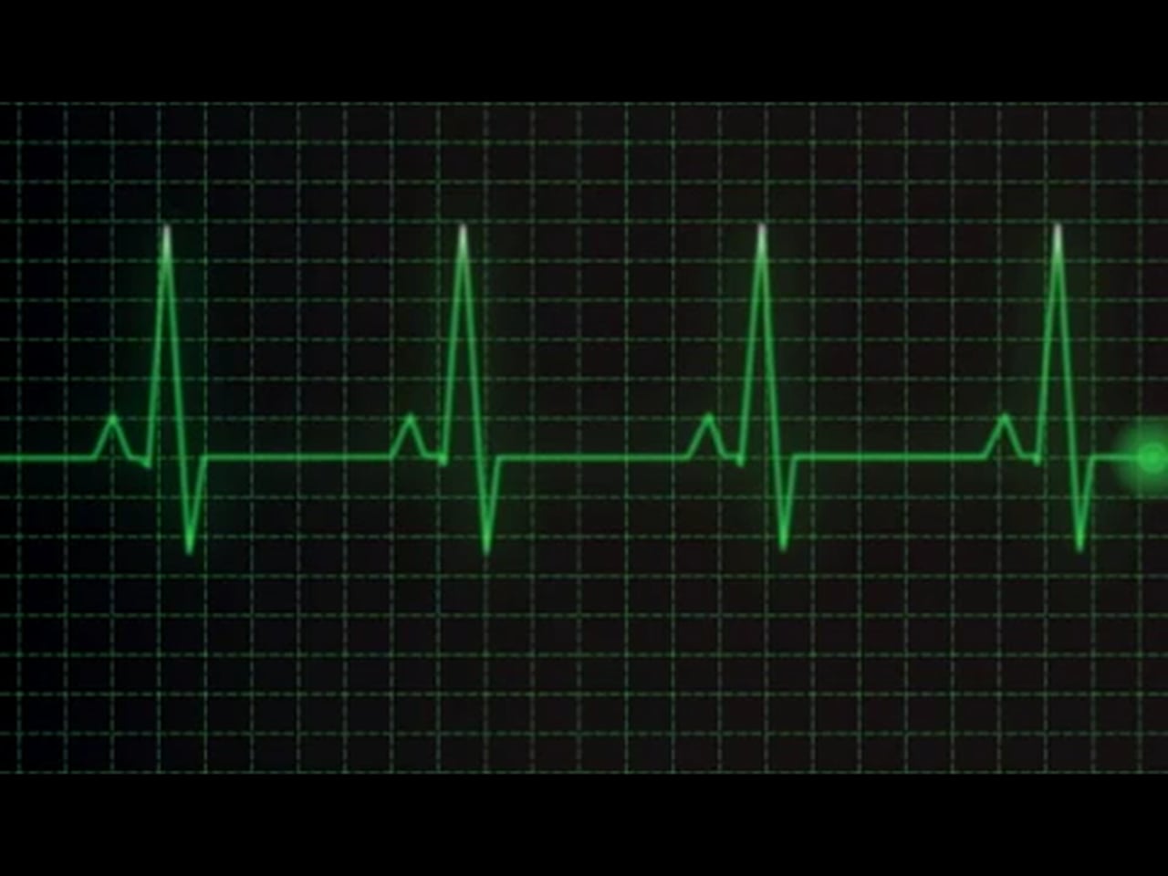 сигнал кардиограммы