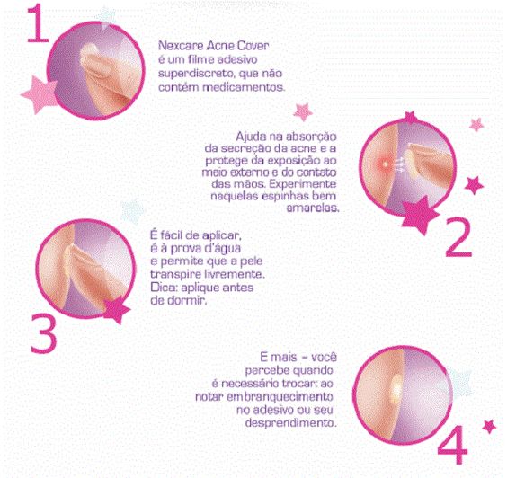 Adesivos que prometem secar espinhas em uma noite Funciona? Maquiando Adesivo De Unha Da Minnie Infantil ~ Adesivos que prometem secar espinhas em uma noite Funciona? Maquiando