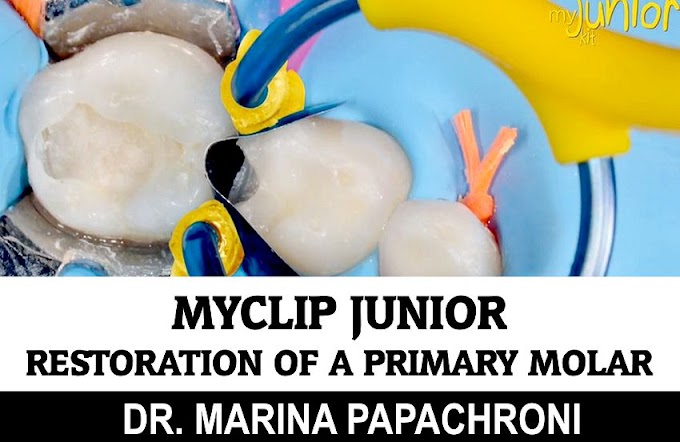 MYCLIP JUNIOR: Restoration of a primary molar - Dr. Marina Papachroni