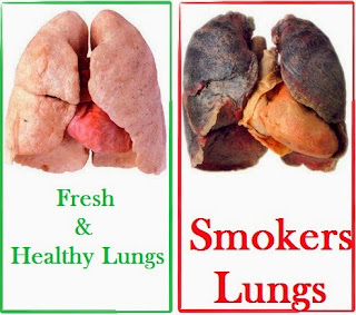 Smoking damage to human health