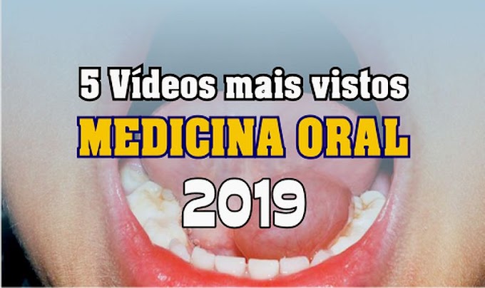 5 Vídeos de MEDICINA ORAL mais vistos em 2019