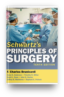 surgery for pgmee pdf