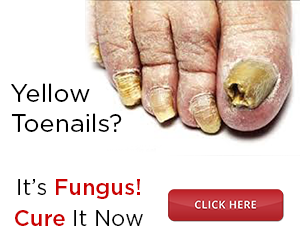 Fungus Protocol