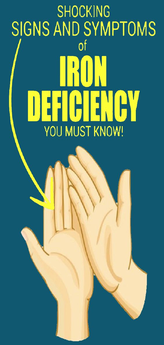 Iron Deficiency Symptoms That You Shouldn’t Ignore medicine health life