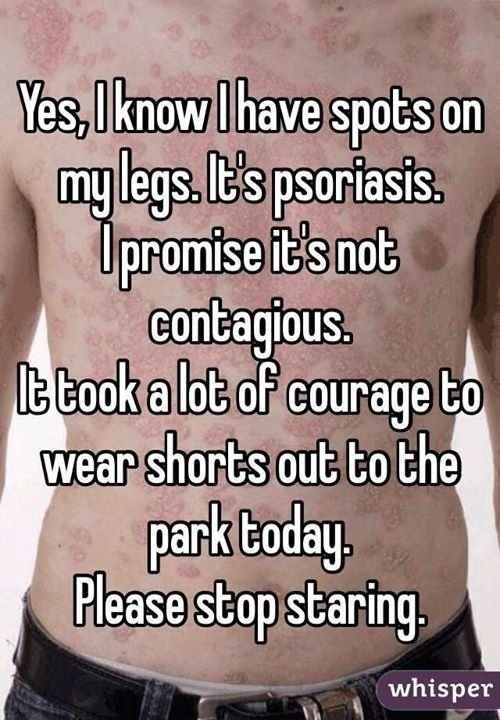 Three Ladies and Three More I have psoriasis