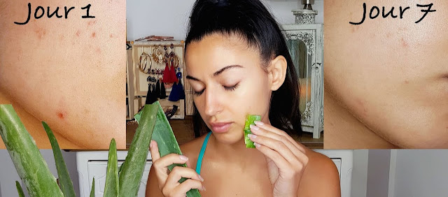 7 Masques à base de l'aloe vera pour avoir peau parfaites sans imperfections