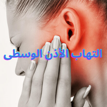 أمراض الأنف والأذن والحنجرة ( التهاب الأذن )
