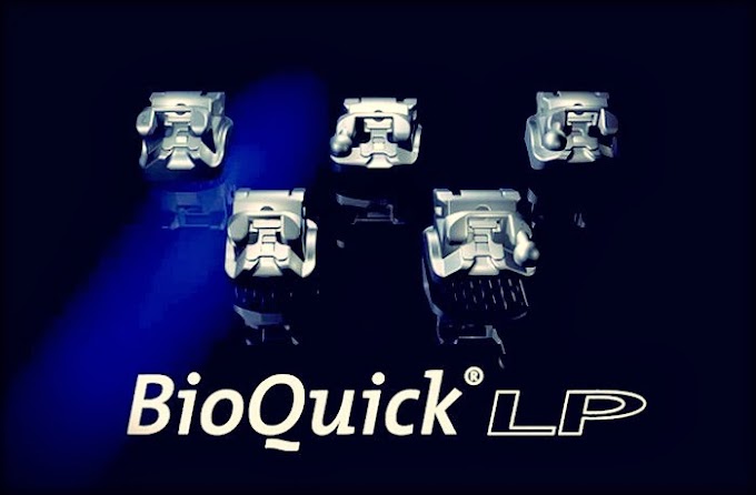 BRACKETS: BioQuick LP - Debonding (Descementación)