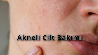 Akneli Cilt Bakımı 