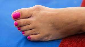 women running shoes with bunions