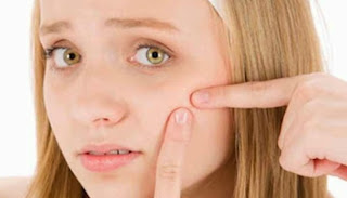 Tips cara menghilangkan komedo di wajah secara alami 