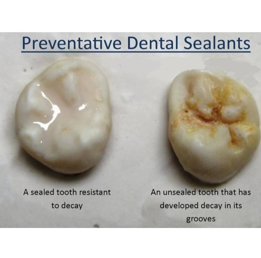 Anderson Lake Dental