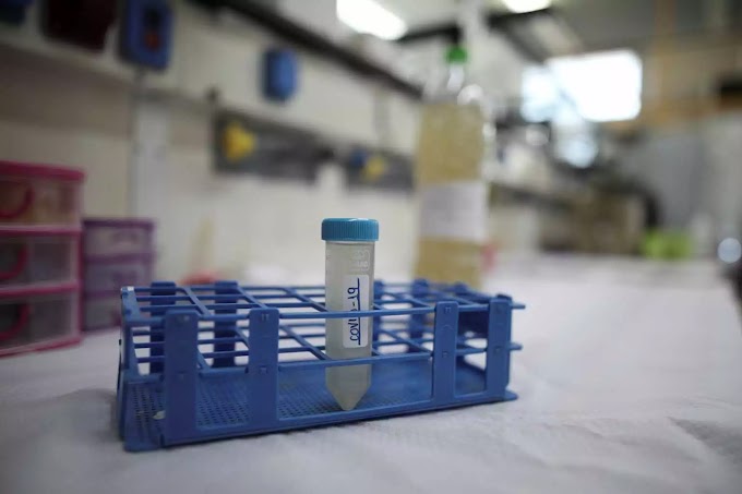 Ο Θωμαΐδης «βλέπει» μείωση κρουσμάτων 