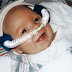 CPAP w leczeniu noworodków