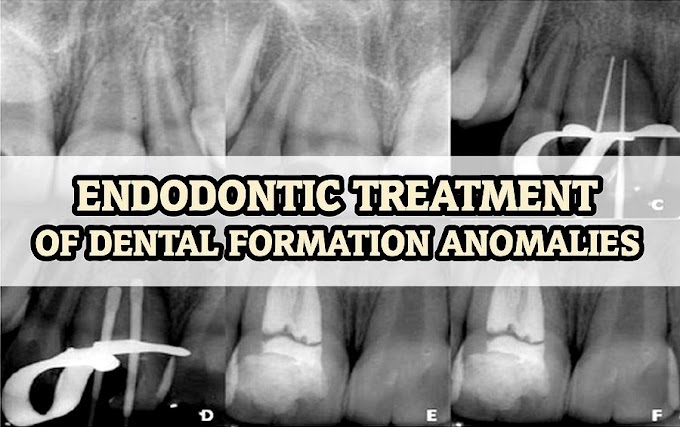 CLINICAL CASE: Endodontic Treatment of dental formation anomalies