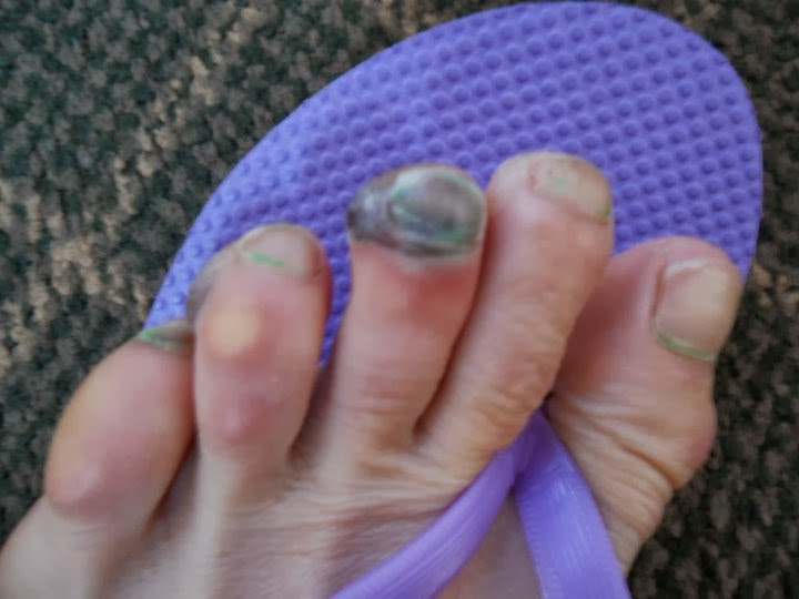 Dim Sum and Long Runs Embarrasing running stories