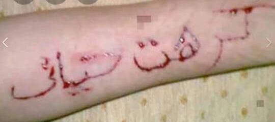 الكاتينج بداية الطريق للانتحار