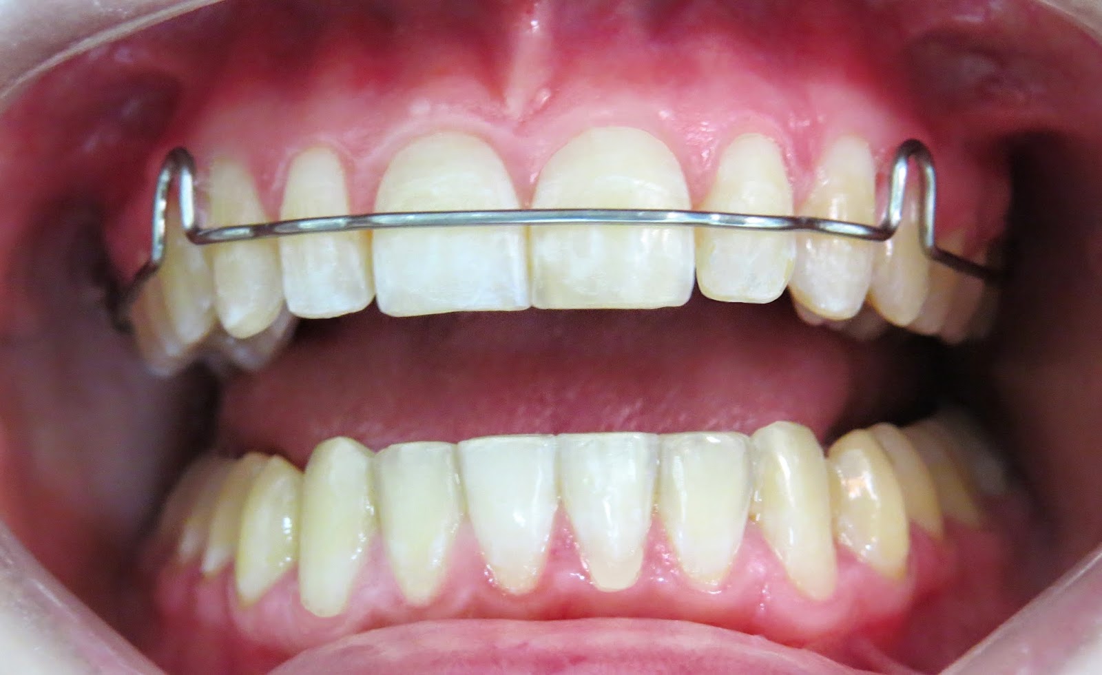 ortodontica