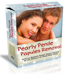 <a href="http://health.producrate.com/pearly-penile-papules-removal-e-book/">Josh Marvin Online</a>