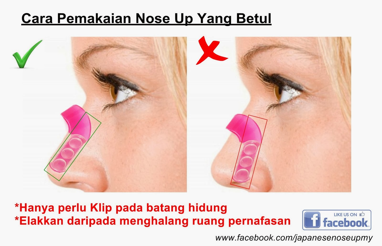 Тейпы для уменьшения носа схемы