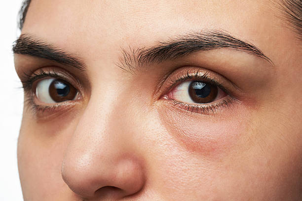 Do you see dark circles under your eyes?
