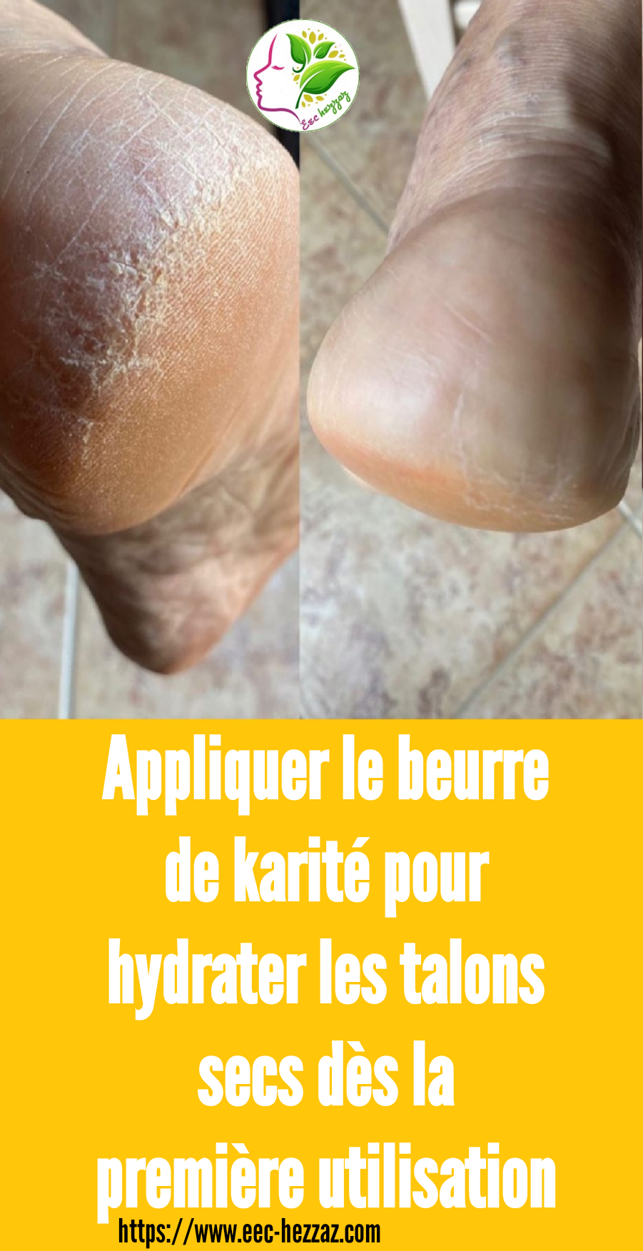 Appliquer le beurre de karité pour hydrater les talons secs dès la première utilisation