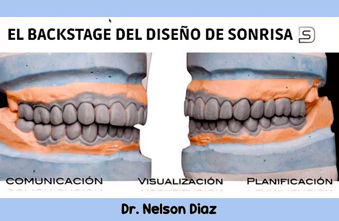 WEBINAR: El backstage del diseño de sonrisa - Dr. Nelson Diaz