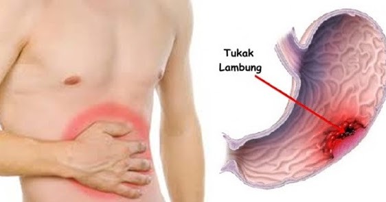 41+ Organ Pencernaan Sapi Yang Berfungsi Untuk Menyerap Sari-Sari Makanan Adalah Pictures