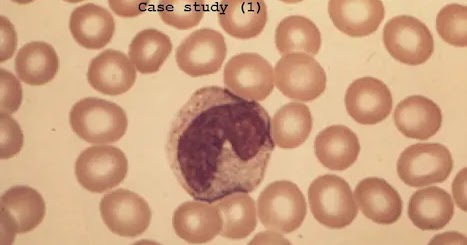 Hematopathology case studies picture