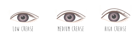 Karen Kho: Why do i redo my Double Eyelids