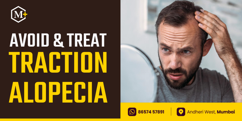 how-to-prevent-traction-alopecia-causes-treatment-for-it-ahs-uae