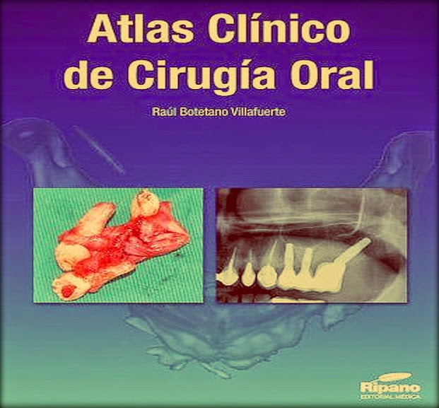 LIBRO: 'Atlas Clínico de Cirugía Oral' - Editorial Ripano