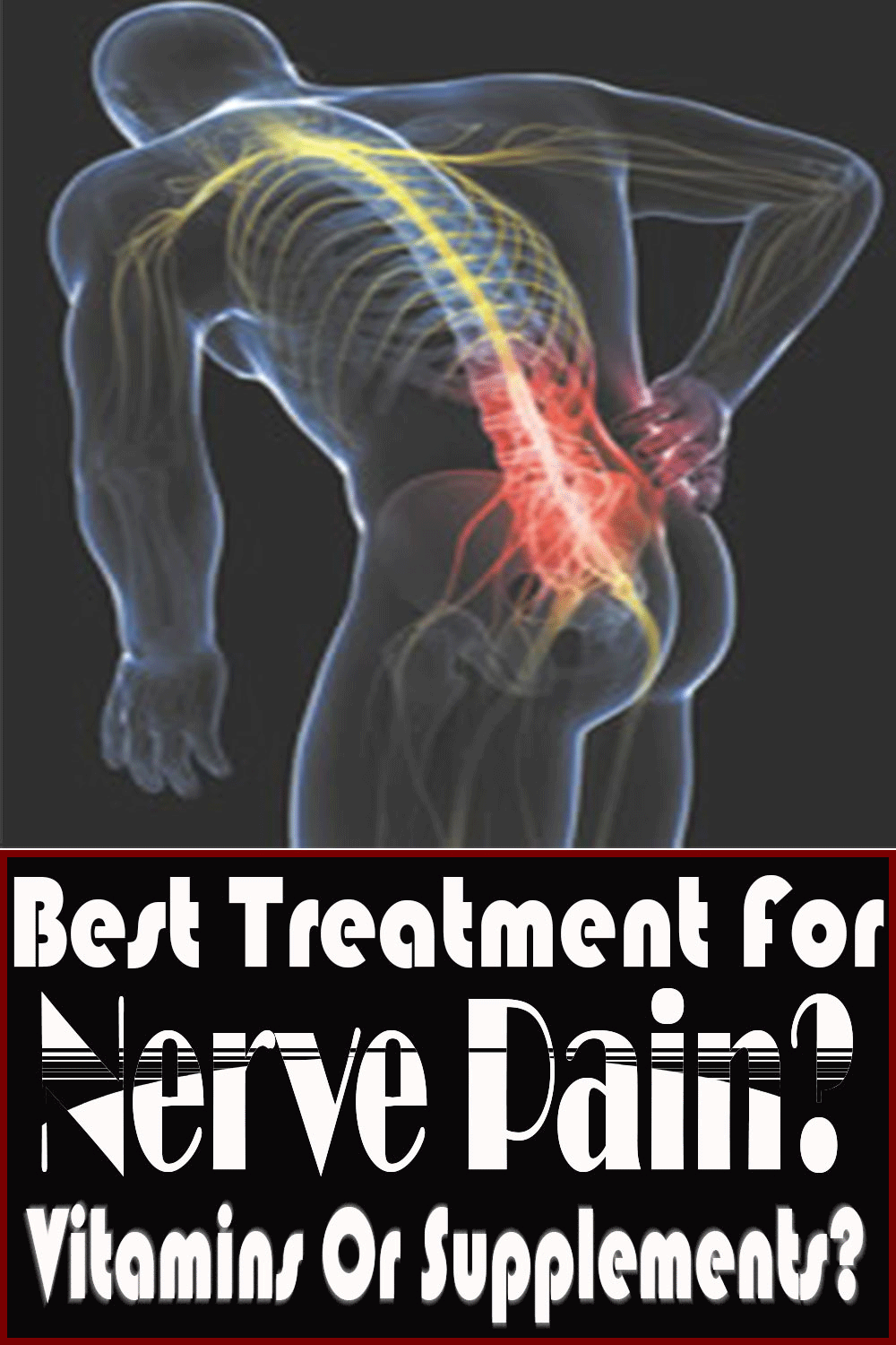 Best Treatment For Nerve Pain? Vitamins Or Supplements?