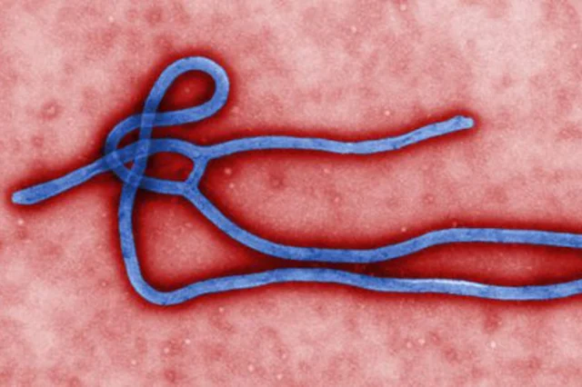 Ebola virus disease (EVD) is a deadly disease with occasional outbreaks that occur primarily on the African continent. EVD most commonly affects people and nonhuman primates (such as monkeys, gorillas, and chimpanzees). It is caused by an infection with a group of viruses within the genus Ebolavirus. Image from the Centers for Disease Control and Prevention