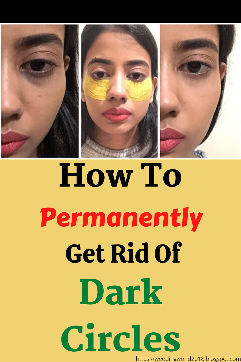 How to Permanently Get Rid of Dark Circles 15 Dark Circles Home