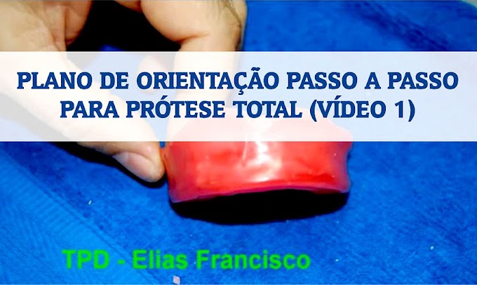 PRÓTESE TOTAL: Plano de orientação passo a passo (VÍDEO 1)