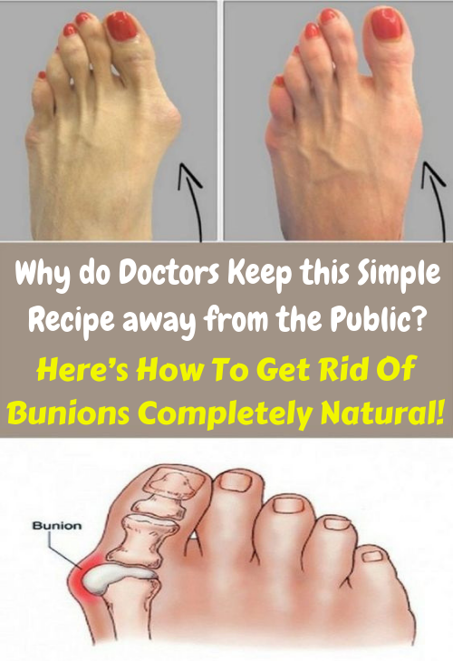 Let Start Slim Today Why Do Doctors Keep This Simple Recipe Away From