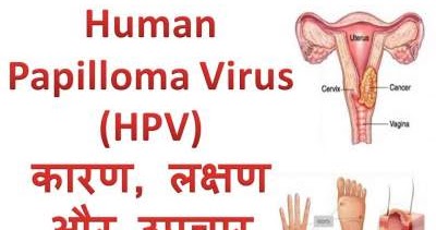 Human Papillomavirus (HPV) à¤¸à¤à¤à¥à¤°à¤®à¤£ à¤à¥ à¤à¤¾à¤°à¤£, à¤²à¤à¥à¤·à¤£ à¤à¤° à¤à¤ªà¤à¤¾à¤°  