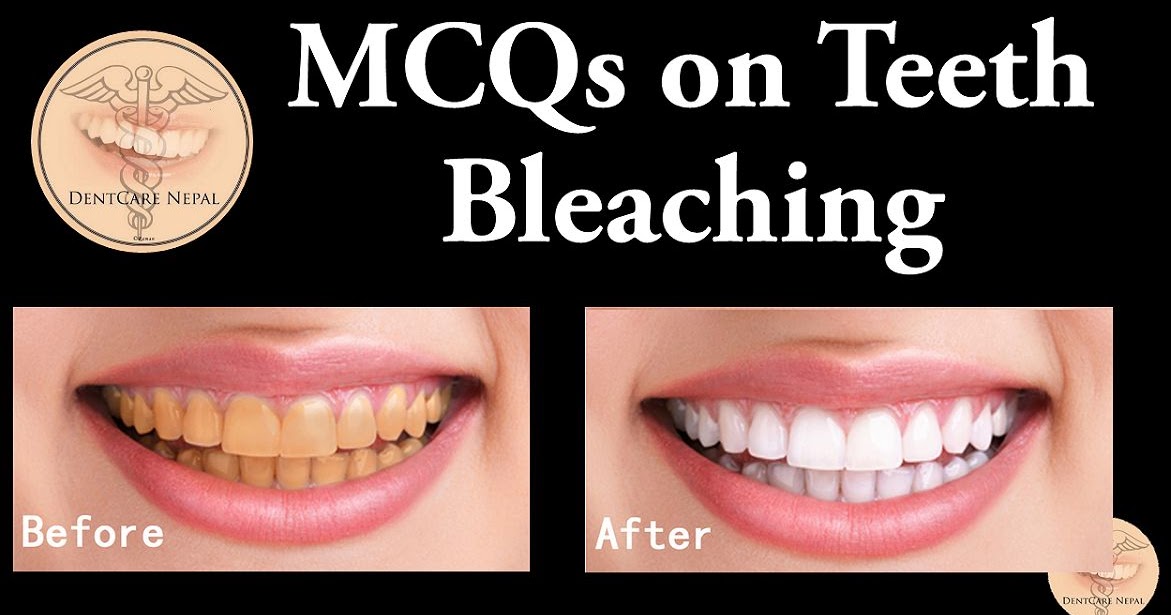 REVIEW Vital and Non Vital Tooth Bleaching OdontoTv