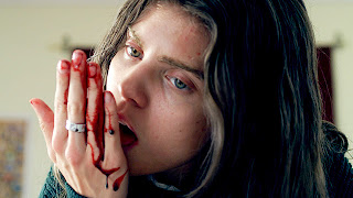 AnnaLynne McCord excision AnnaLynne McCord excision
