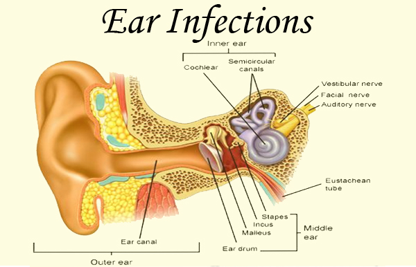 Everything You Need To Know About Ear Infection.