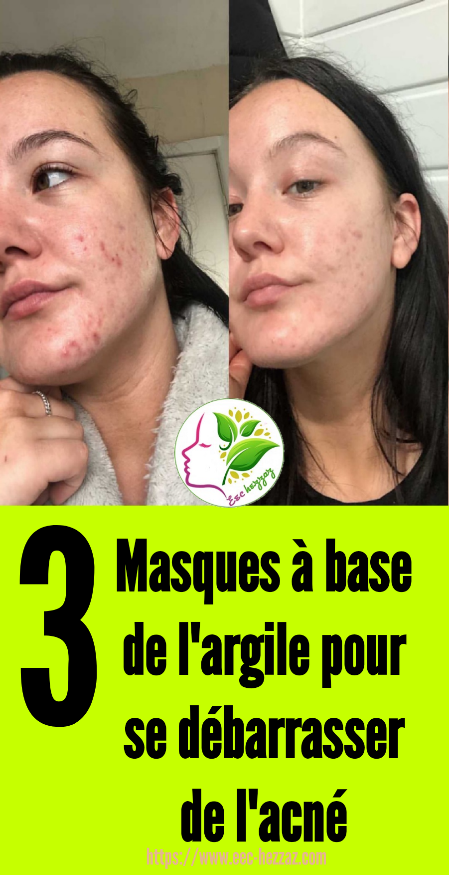 3 Masques à base de l'argile pour se débarrasser de l'acné