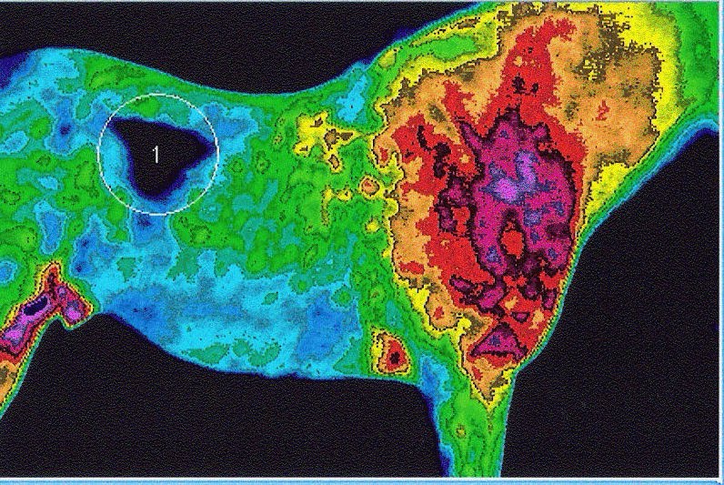 ANTIAGEING an Independent Lifewave Distributor Thermal Imaging and