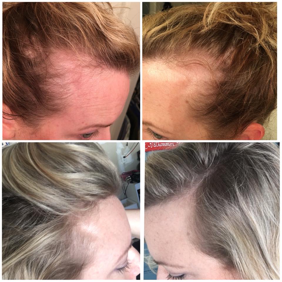 Monat By Brooke Pcos Testimonial