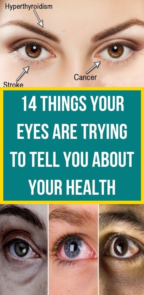 14 Things Your Eyes Are Trying To Tell You About Your Health wellness