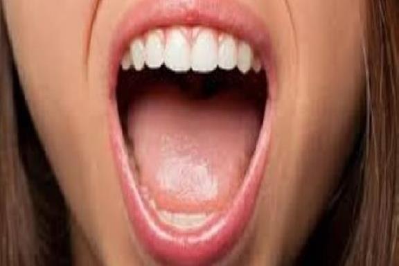 جفاف الفم: الأسياب والعلاج