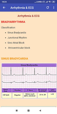 A to Z ECG Interpretation